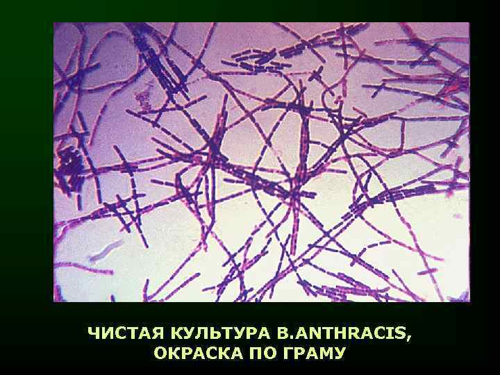 ЧИСТАЯ КУЛЬТУРА B. ANTHRACIS, ОКРАСКА ПО ГРАМУ 