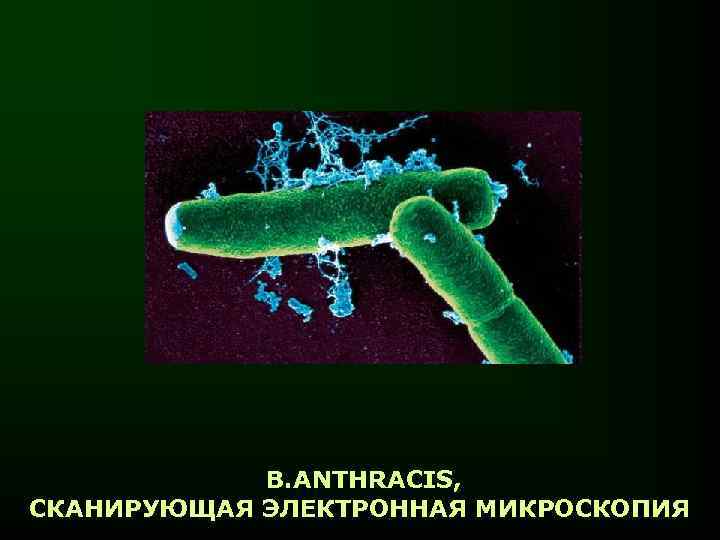 B. ANTHRACIS, СКАНИРУЮЩАЯ ЭЛЕКТРОННАЯ МИКРОСКОПИЯ 