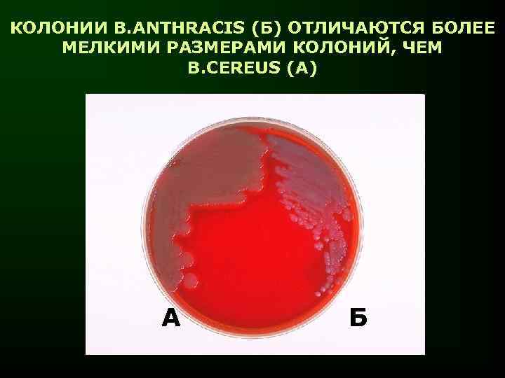 КОЛОНИИ B. ANTHRACIS (Б) ОТЛИЧАЮТСЯ БОЛЕЕ МЕЛКИМИ РАЗМЕРАМИ КОЛОНИЙ, ЧЕМ B. CEREUS (А) А