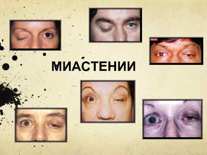 МИАСТЕНИИ 