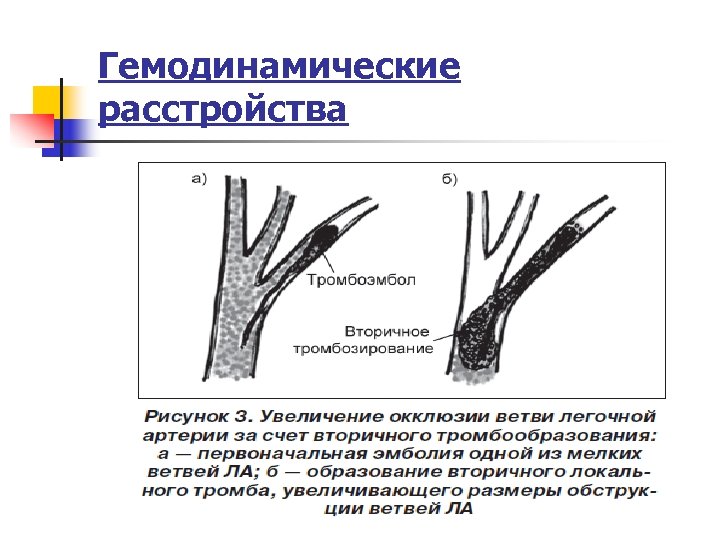 Гемодинамические расстройства 