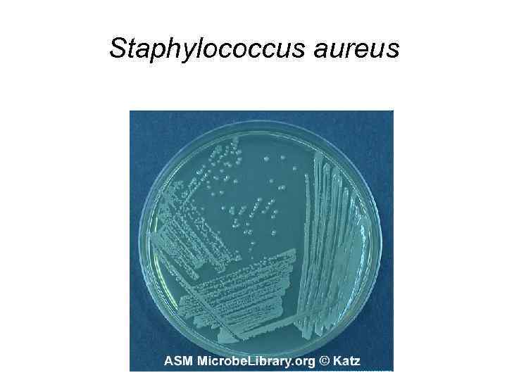 Staphylococcus aureus 