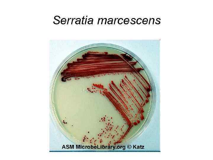 Serratia marcescens 