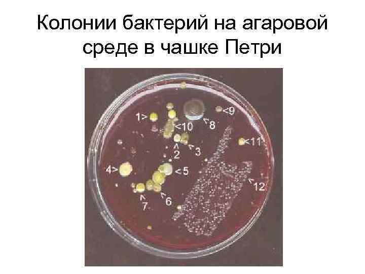 Колонии бактерий на агаровой среде в чашке Петри 
