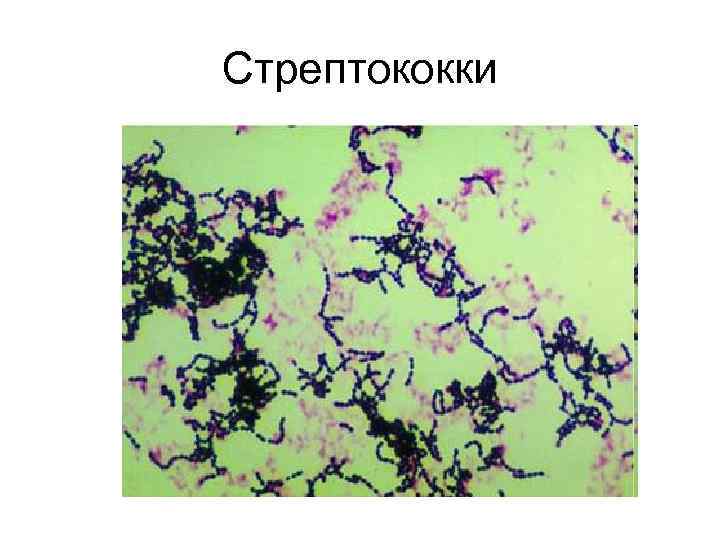 Стрептококки 