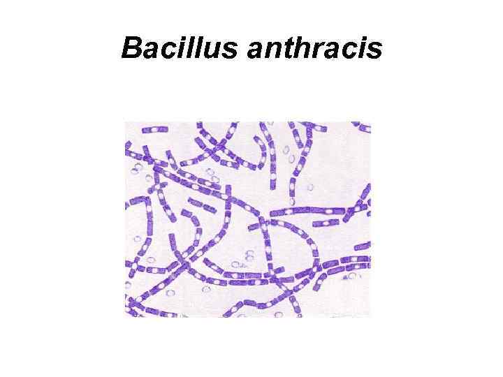 Bacillus anthracis 