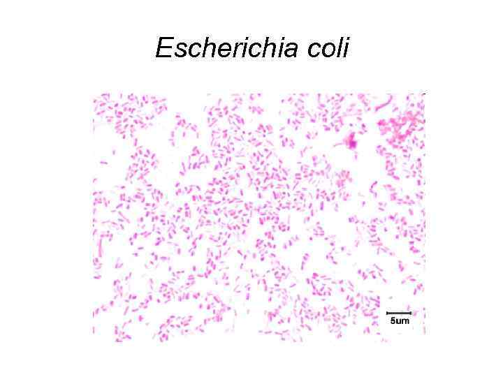 Escherichia coli 