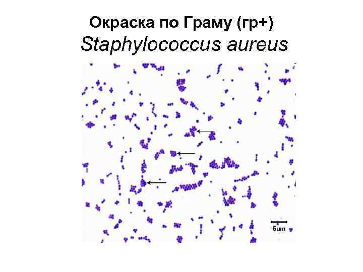 Окраска по Граму (гр+) Staphylococcus aureus 