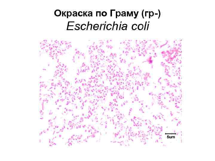 Окраска по Граму (гр-) Escherichia coli 
