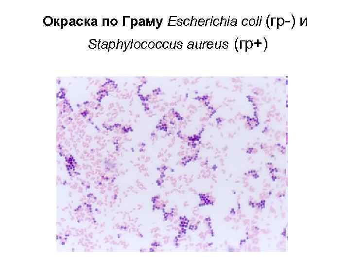 Окраска по Граму Escherichia coli (гр-) и Staphylococcus aureus (гр+) 