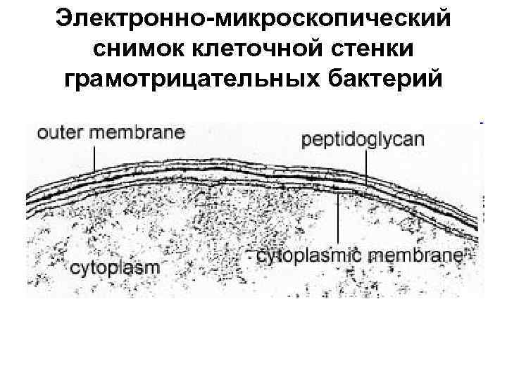 Электронно-микроскопический снимок клеточной стенки грамотрицательных бактерий 
