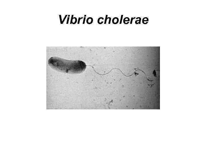 Vibrio cholerae 