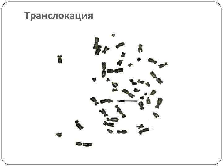 Транслокация 