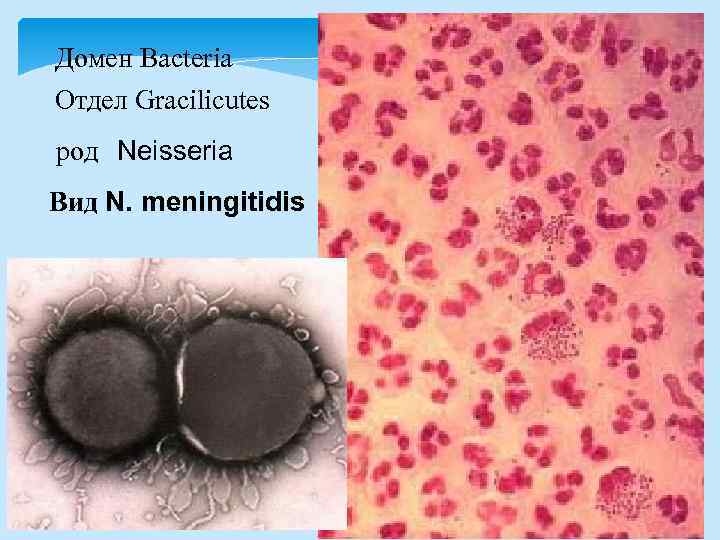 Домен Bacteria Отдел Gracilicutes род Neisseria Вид N. meningitidis 