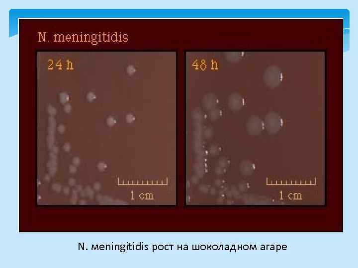 N. мeningitidis рост на шоколадном агаре 