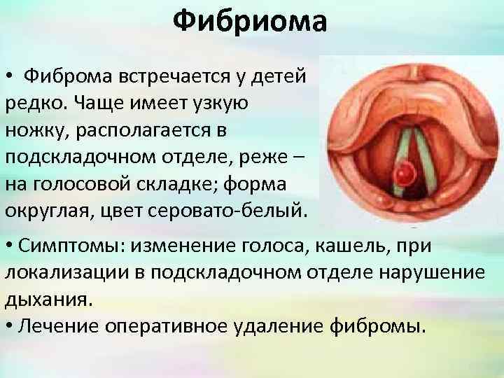 Фибриома • Фиброма встречается у детей редко. Чаще имеет узкую ножку, располагается в подскладочном