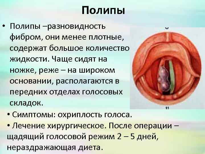 Полипы • Полипы –разновидность фибром, они менее плотные, содержат большое количество жидкости. Чаще сидят