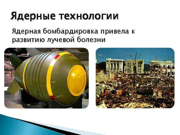 Ядерные технологии Ядерная бомбардировка привела к развитию лучевой болезни 