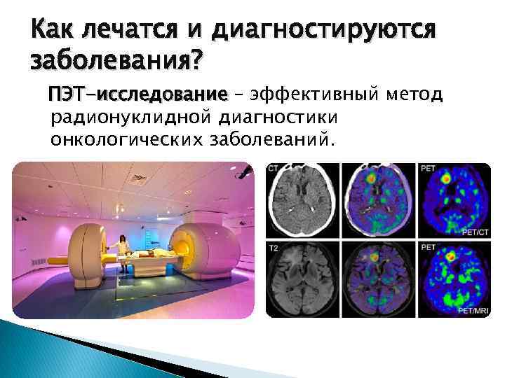 Как лечатся и диагностируются заболевания? ПЭТ-исследование – эффективный метод радионуклидной диагностики онкологических заболеваний. 