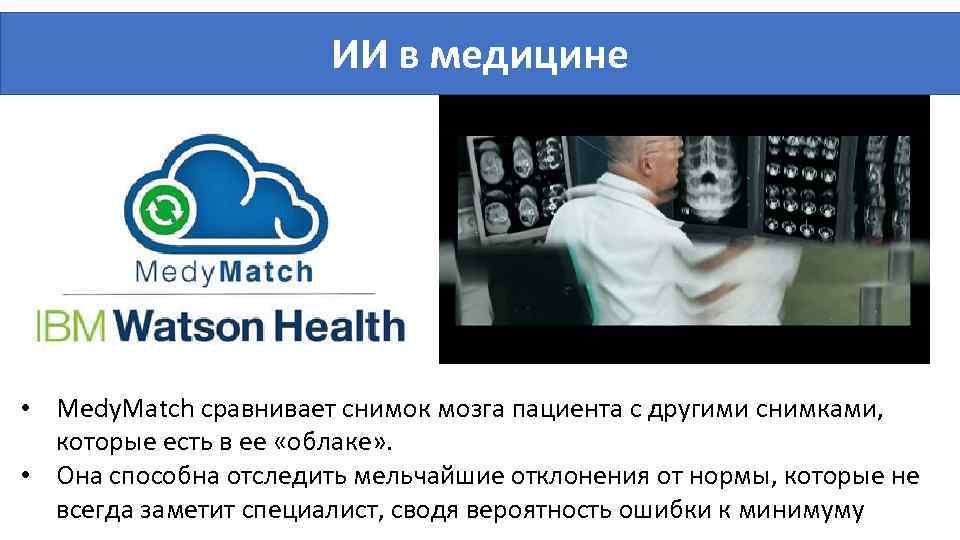 ИИ в медицине • Medy. Match сравнивает снимок мозга пациента с другими снимками, которые