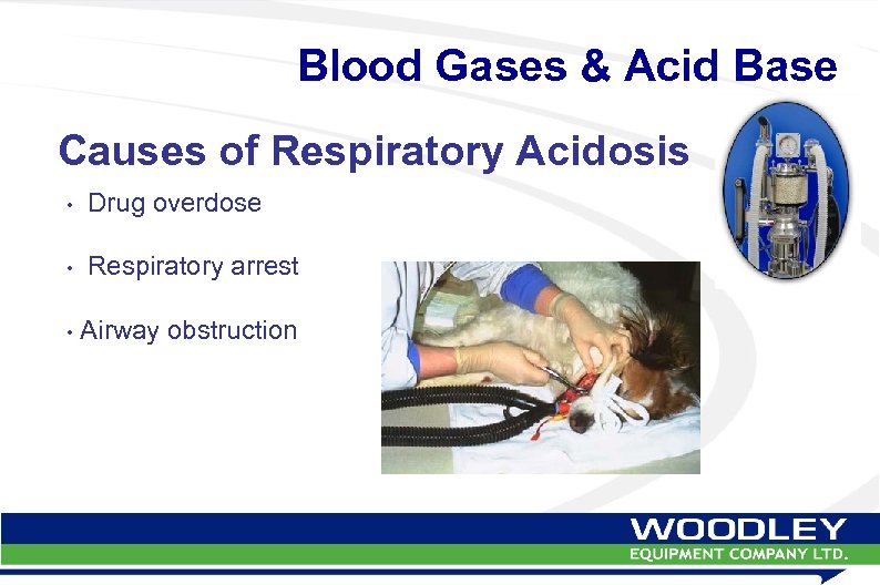 Blood Gases & Acid Base Causes of Respiratory Acidosis • Drug overdose • Respiratory