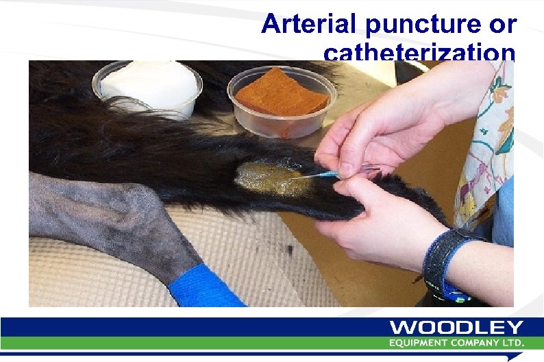 Arterial puncture or catheterization 