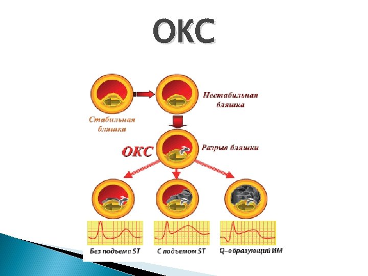 Тест окс коронарный синдром