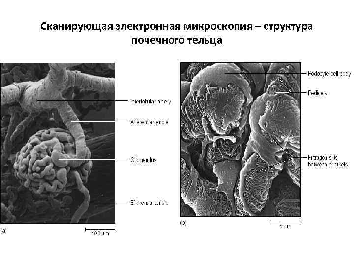 Сканирующая электронная микроскопия – структура почечного тельца 