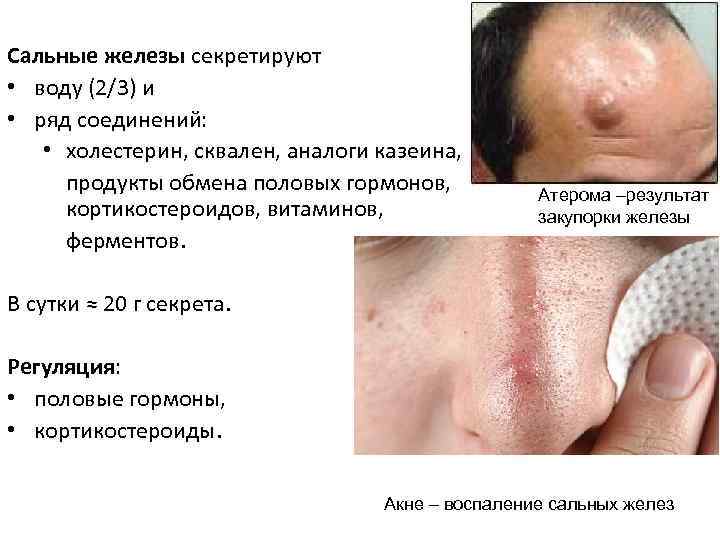 Сальные железы секретируют • воду (2/3) и • ряд соединений: • холестерин, сквален, аналоги
