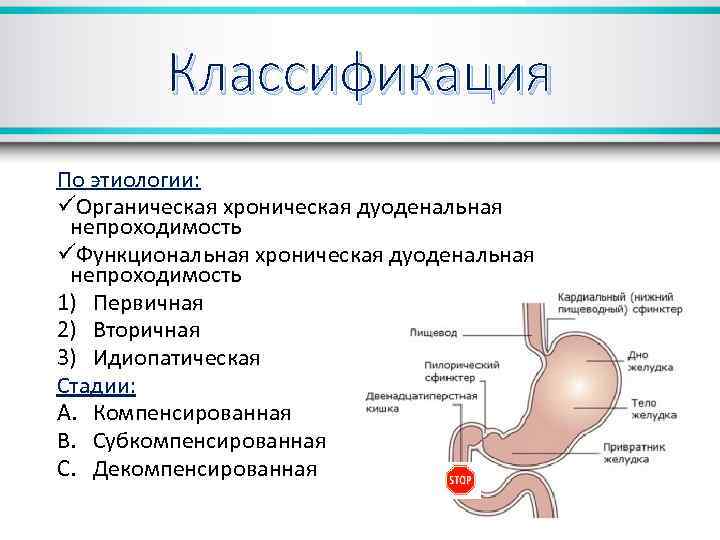 Классификация По этиологии: üОрганическая хроническая дуоденальная непроходимость üФункциональная хроническая дуоденальная непроходимость 1) Первичная 2)