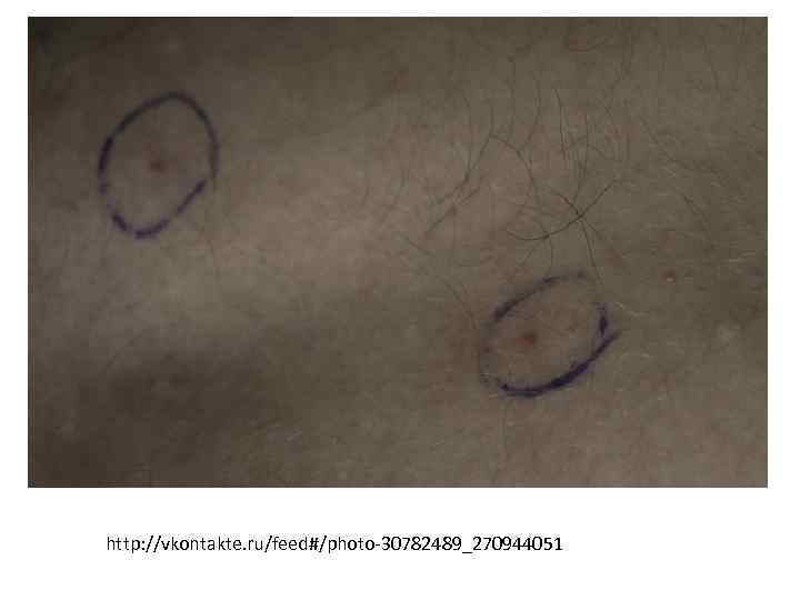 http: //vkontakte. ru/feed#/photo-30782489_270944051 