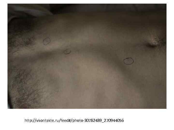 http: //vkontakte. ru/feed#/photo-30782489_270944056 