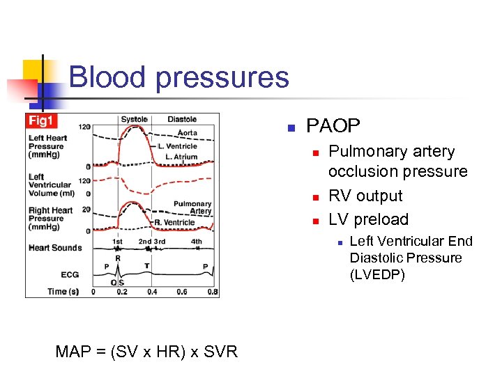 Blood pressures n PAOP n n n Pulmonary artery occlusion pressure RV output LV