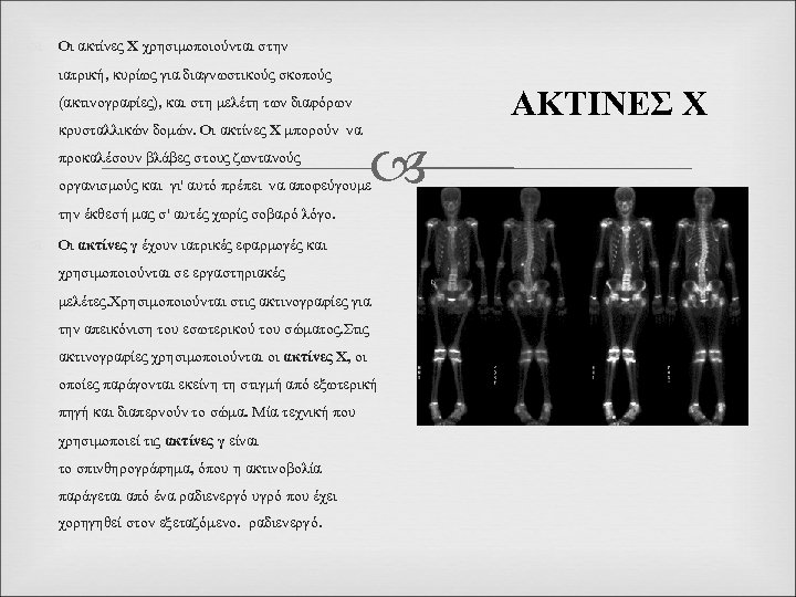  Οι ακτίνες Χ χρησιμοποιούνται στην ιατρική, κυρίως για διαγνωστικούς σκοπούς ΑΚΤΙΝΕΣ Χ (ακτινογραφίες),