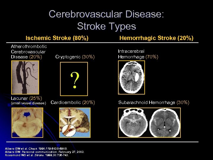 Cerebrovascular Disease: Stroke Types Ischemic Stroke (80%) Atherothrombotic Cerebrovascular Disease (20%) Cryptogenic (30%) Hemorrhagic