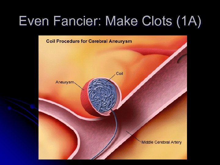 Even Fancier: Make Clots (1 A) 