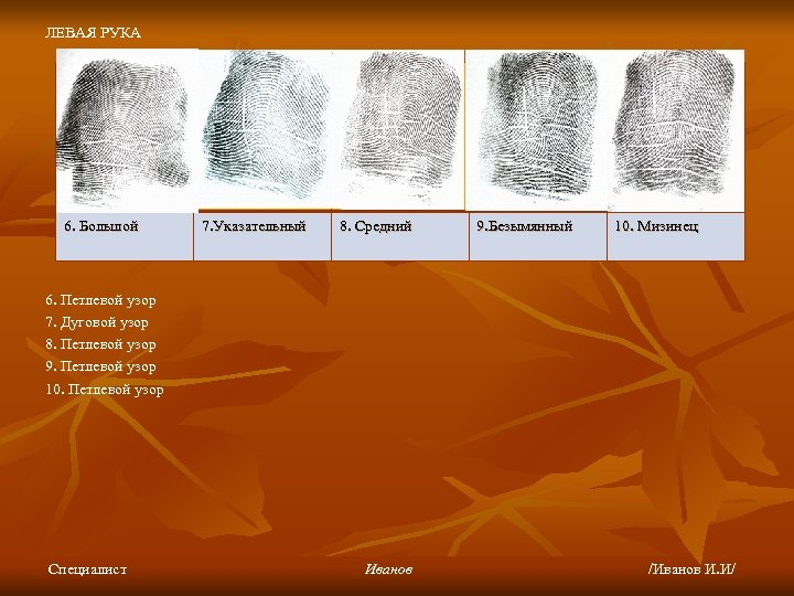 ЛЕВАЯ РУКА 6. Большой 7. Указательный 8. Средний 9. Безымянный 10. Мизинец 6. Петлевой