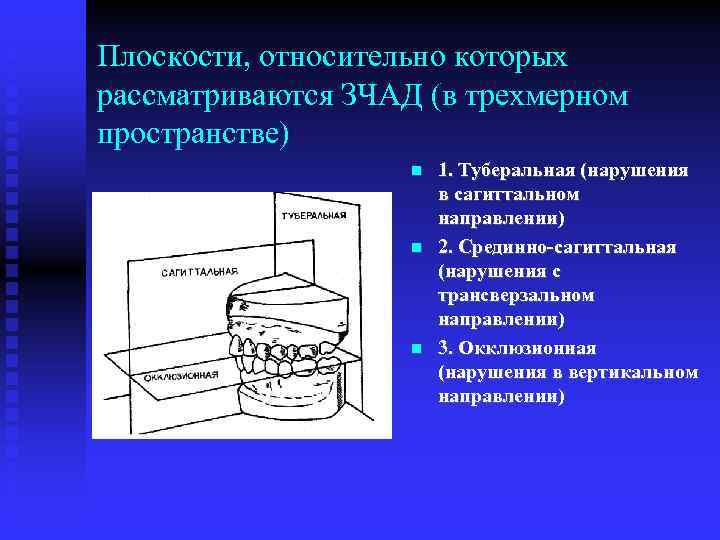 Плоскости, относительно которых рассматриваются ЗЧАД (в трехмерном пространстве) 1. Туберальная (нарушения в сагиттальном направлении)