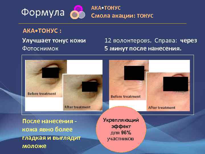 Формула AКA • TOНУС : Улучшает тонус кожи Фотоснимок После нанесения кожа явно более