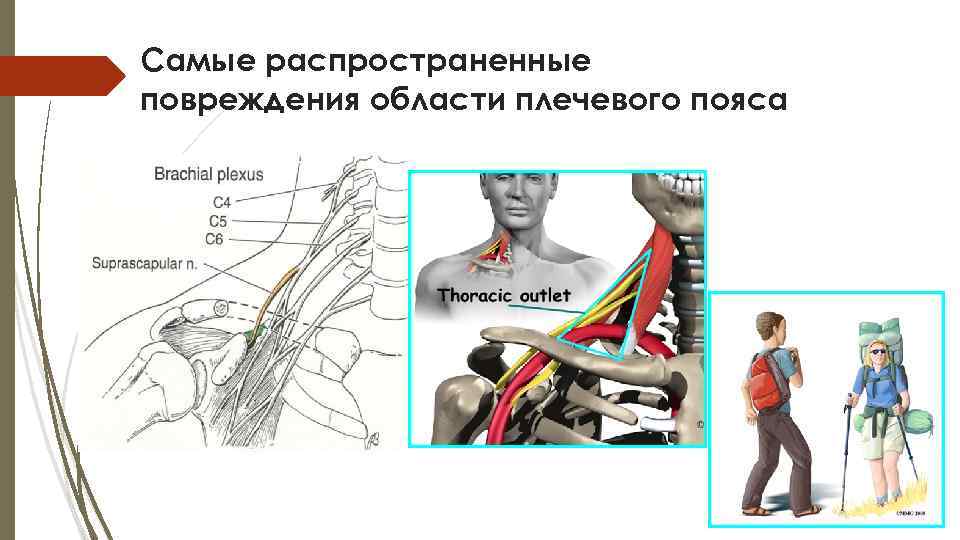 Самые распространенные повреждения области плечевого пояса 