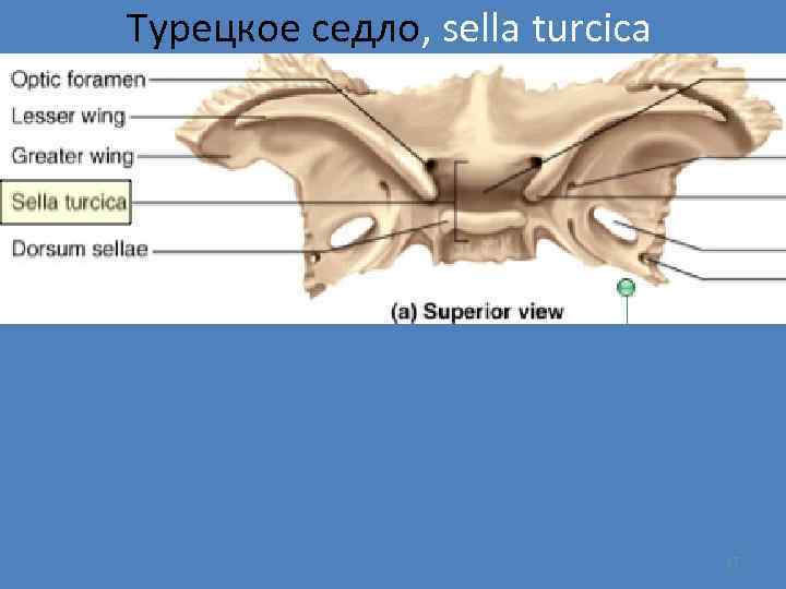 Турецкое седло, sella turcica 17 