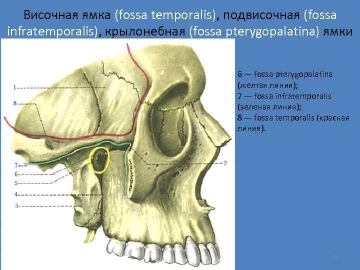 Височная ямка (fossa temporalis), подвисочная (fossa infratemporalis), крылонебная (fossa pterygopalatina) ямки 6 — fossa