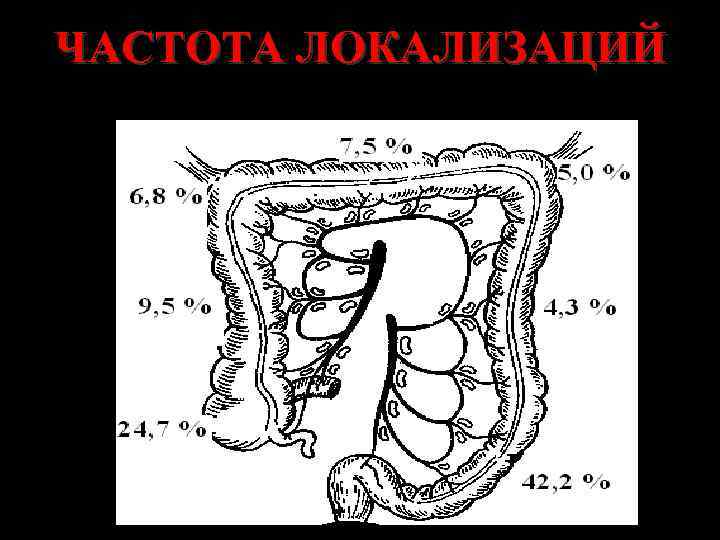 ЧАСТОТА ЛОКАЛИЗАЦИЙ 