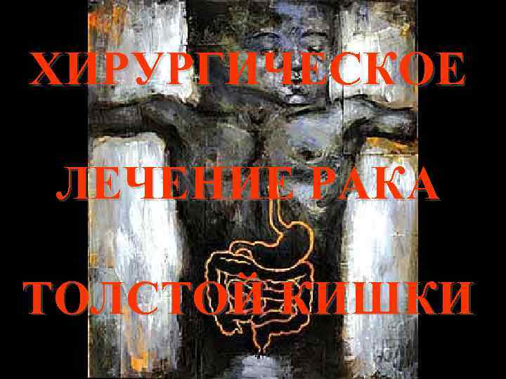 ХИРУРГИЧЕСКОЕ ЛЕЧЕНИЕ РАКА ТОЛСТОЙ КИШКИ 