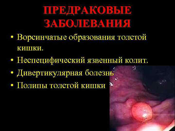 ПРЕДРАКОВЫЕ ЗАБОЛЕВАНИЯ • Ворсинчатые образования толстой кишки. • Неспецифический язвенный колит. • Дивертикулярная болезнь