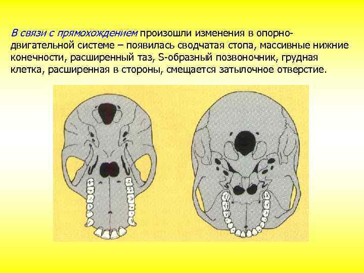 В связи с прямохождением произошли изменения в опорно- двигательной системе – появилась сводчатая стопа,