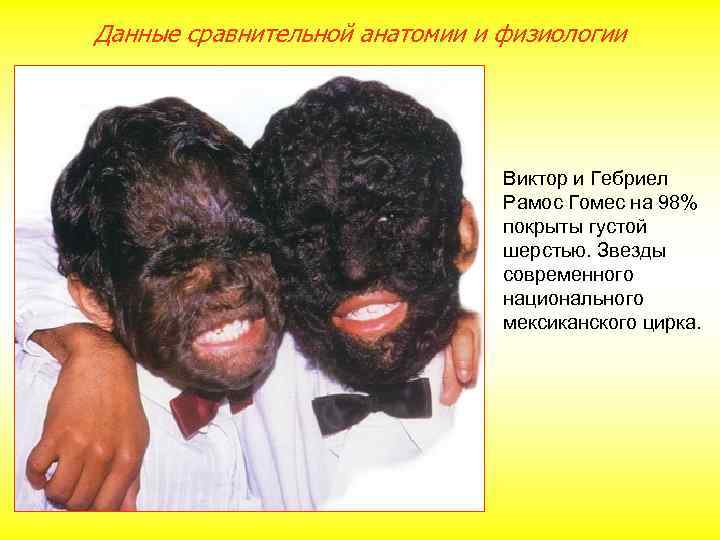 Данные сравнительной анатомии и физиологии Виктор и Гебриел Рамос Гомес на 98% покрыты густой