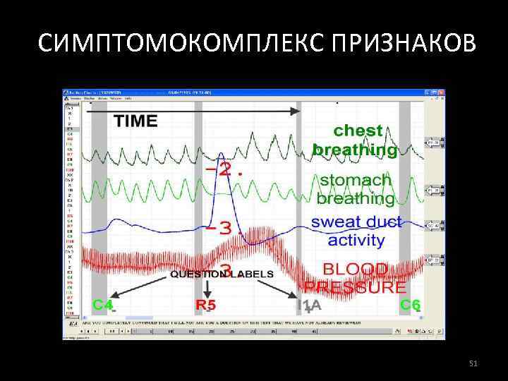 СИМПТОМОКОМПЛЕКС ПРИЗНАКОВ 51 