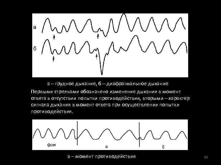  а – грудное дыхание, б – диафрагмальное дыхание Первыми стрелками обозначено изменение дыхания