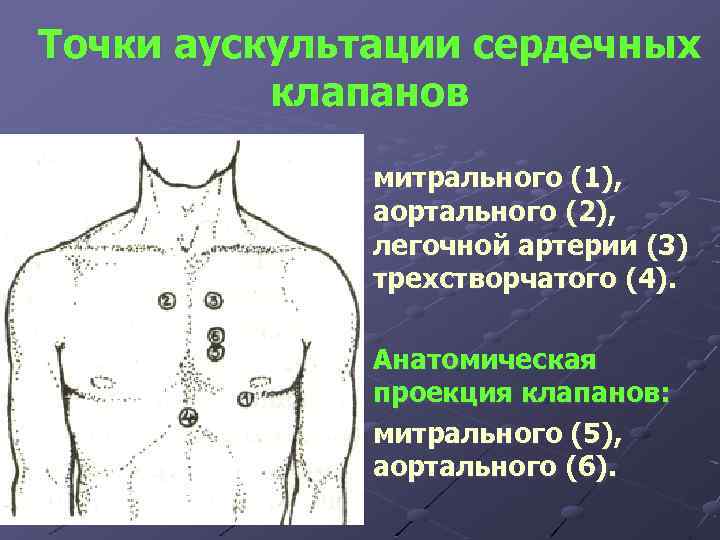 Точки аускультации сердечных клапанов митрального (1), аортального (2), легочной артерии (3) трехстворчатого (4). Анатомическая